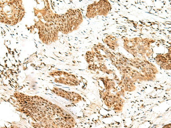 RBM19 Polyclonal Antibody (E-AB-18872)