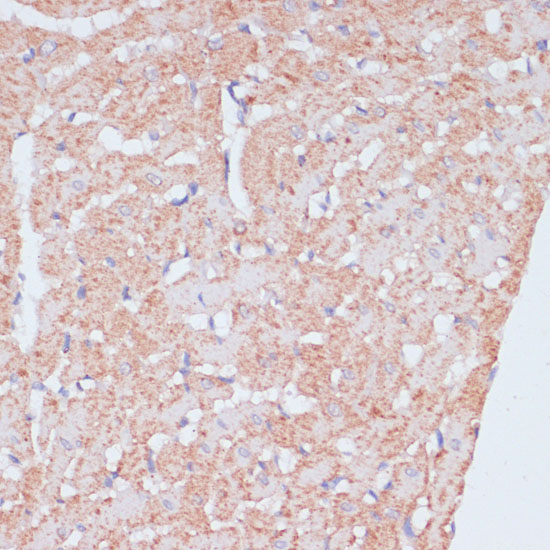 MZB1 Polyclonal Antibody (E-AB-66290)