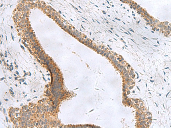 CEMIP Polyclonal Antibody (E-AB-18187)