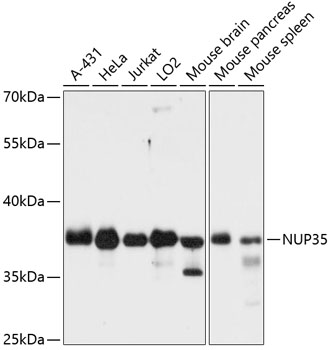 NUP35 Polyclonal Antibody (E-AB-64319)