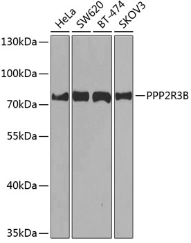 PPP2R3B Polyclonal Antibody (E-AB-63099)