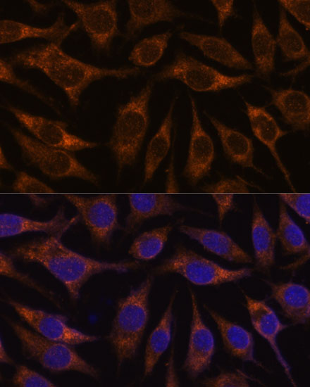 AGR2 Polyclonal Antibody (E-AB-67817)