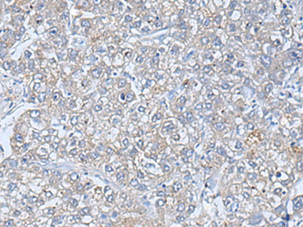 TREM1 Polyclonal Antibody (E-AB-52226)