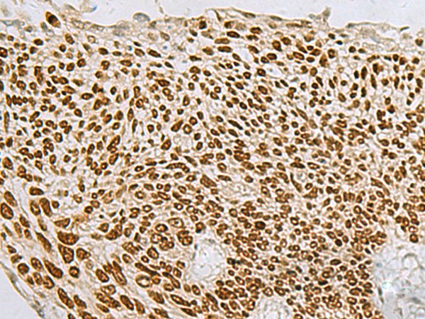 TP63 Polyclonal Antibody (E-AB-18722)