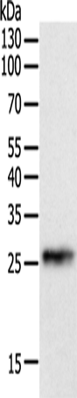 CRP Polyclonal Antibody (E-AB-14018)
