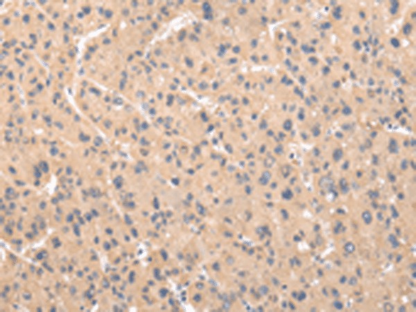 ZNF268 Polyclonal Antibody (E-AB-18327)
