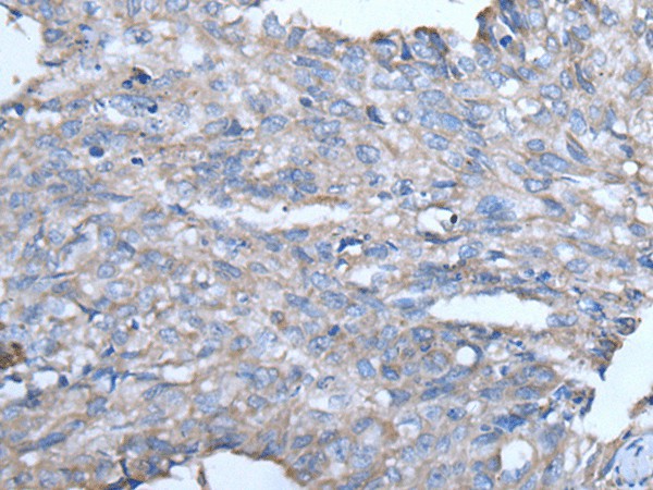 GJA1 Polyclonal Antibody (E-AB-18224)