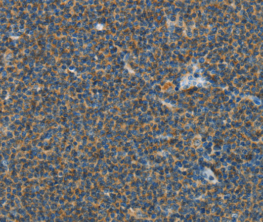 PITX3 Polyclonal Antibody (E-AB-16190)