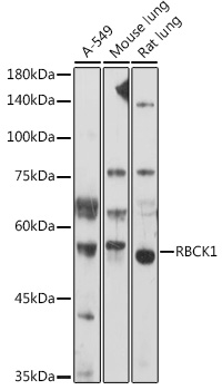 RBCK1 Polyclonal Antibody (E-AB-92252)