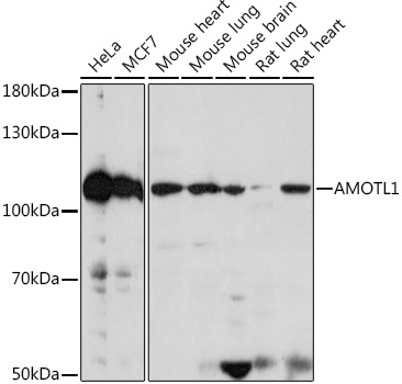 AMOTL1 Polyclonal Antibody (E-AB-91975)