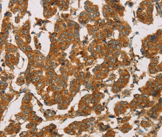 DLL4 Polyclonal Antibody (E-AB-14955)