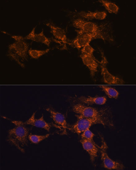 PYCR2 Polyclonal Antibody (E-AB-65220)