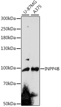 INPP4B Polyclonal Antibody (E-AB-91538)