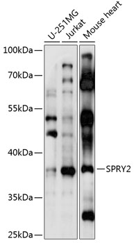 SPRY2 Polyclonal Antibody (E-AB-92086)