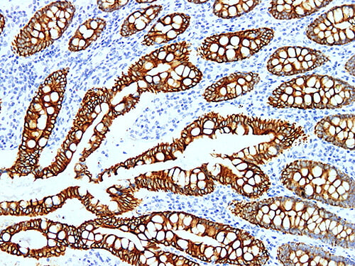 CK19 Monoclonal Antibody (ELAB6577-M)