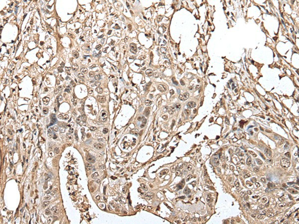 UTP3 Polyclonal Antibody (E-AB-18520)