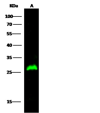 Recombinant HPGD/15-PGDH Monoclonal Antibody (AN300531P)