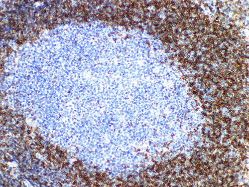 BCL2 Monoclonal Antibody (ELAB6901-M)