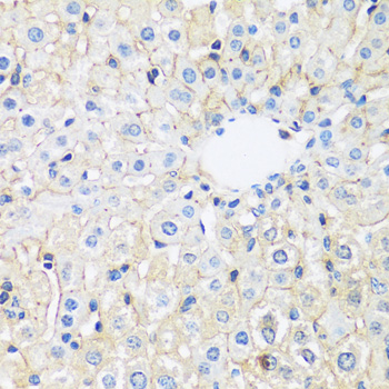 ARL4A Polyclonal Antibody (E-AB-67037)