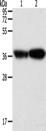 TPM2 Polyclonal Antibody (E-AB-16102)