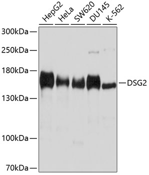 DSG2 Polyclonal Antibody (E-AB-92354)