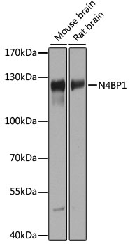 N4BP1 Polyclonal Antibody (E-AB-90733)