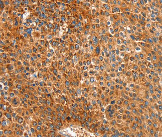 ALDH1A2 Polyclonal Antibody (E-AB-12959)
