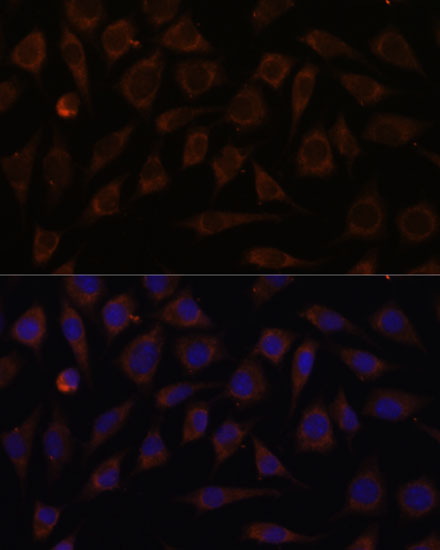 VILL Polyclonal Antibody (E-AB-66484)