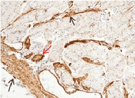 Recombinant CD146/MCAM Monoclonal Antibody (AN300300P)