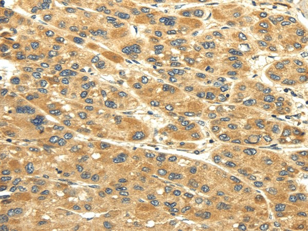 UACA Polyclonal Antibody (E-AB-17184)