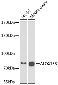 ALOX15B Polyclonal Antibody (E-AB-61370)