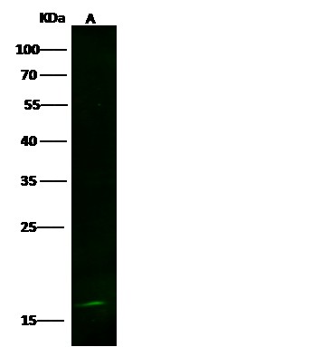 Recombinant LSM1 Monoclonal Antibody (AN300447P)