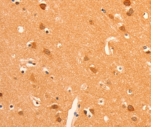 GRM3 Polyclonal Antibody (E-AB-10350)
