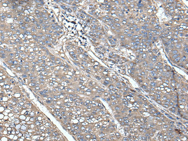 UNC13B Polyclonal Antibody (E-AB-52441)