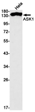Recombinant ASK1 Monoclonal Antibody (E-AB-81532)