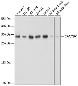 (KO Validated) CACYBP Polyclonal Antibody (E-AB-63904)