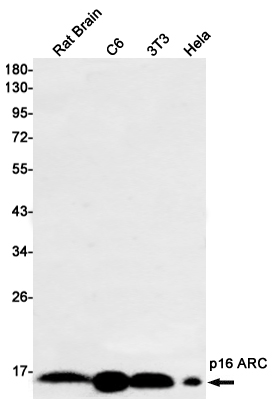 Recombinant p16 ARC Monoclonal Antibody (E-AB-81590)