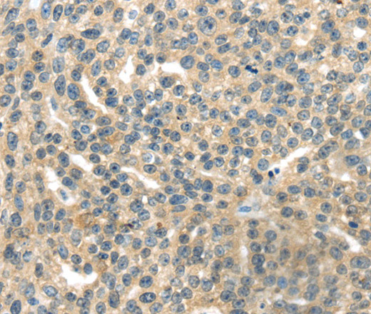 RASA2 Polyclonal Antibody (E-AB-13557)