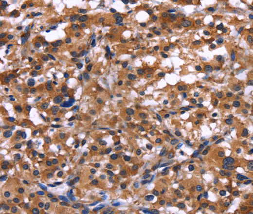 IL1A Polyclonal Antibody (E-AB-10391)
