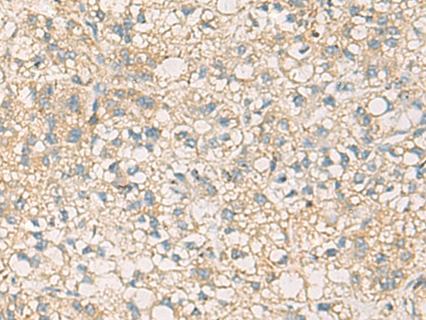 STX6 Polyclonal Antibody (E-AB-53119)