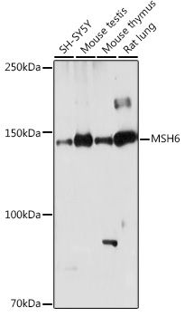 MSH6 Polyclonal Antibody (E-AB-92368)