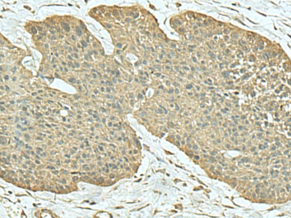 FN3KRP Polyclonal Antibody (E-AB-18182)