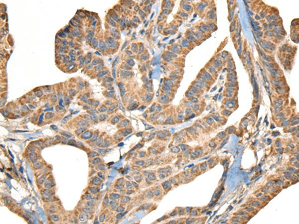 SLAMF7 Polyclonal Antibody (E-AB-18222)