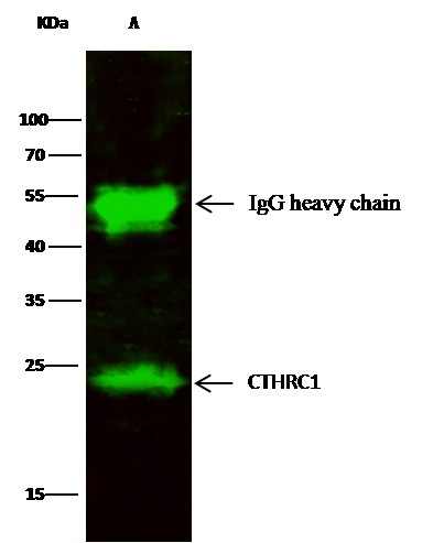 Recombinant CTHRC1 Monoclonal Antibody (AN300237P)