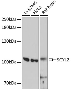 SCYL2 Polyclonal Antibody (E-AB-64490)