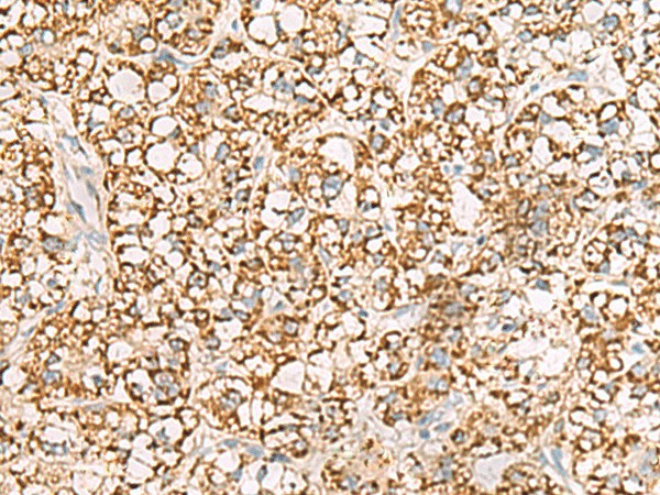 ISOC2 Polyclonal Antibody (E-AB-18797)