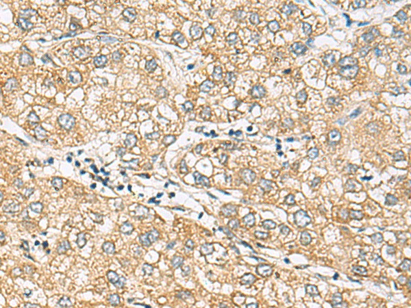 DACT3 Polyclonal Antibody (E-AB-18641)
