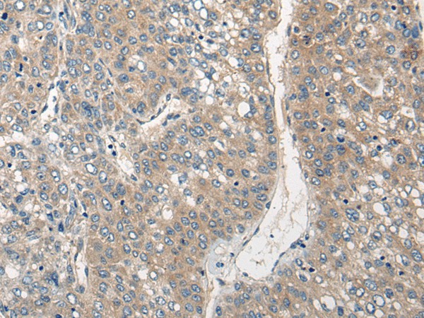 CLIC6 Polyclonal Antibody (E-AB-17806)