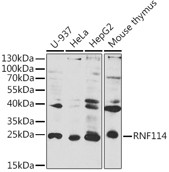 RNF114 Polyclonal Antibody (E-AB-90227)