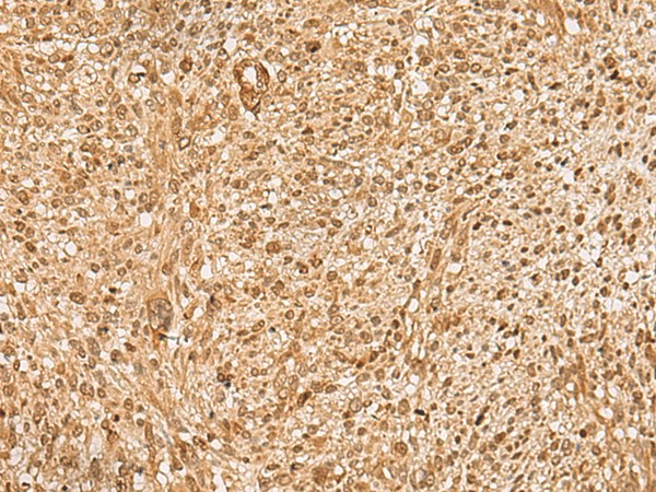 HIRIP3 Polyclonal Antibody (E-AB-18848)